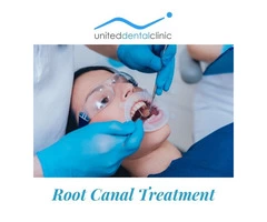 Things Everyone Gets Wrong About Root Canal Treatment | United Dental Clinic