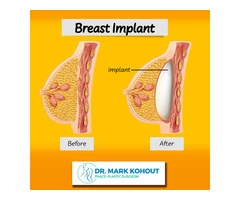 best tummy tuck surgeon