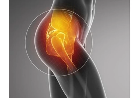 Hip Arthroscopy, Impingement & Labral Tear | PJS Orthopaedics Melbourne - 2/4