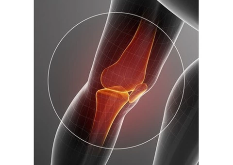 Hip Arthroscopy, Impingement & Labral Tear | PJS Orthopaedics Melbourne - 3/4