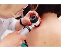 Mole Mapping Melbourne - Manningham Skin Cancer Clinic