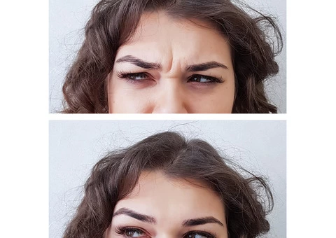 Get Treatment for Static Wrinkles