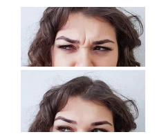 Get Treatment for Static Wrinkles