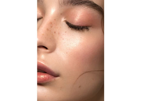 Skin Needling Melbourne - Regenerer