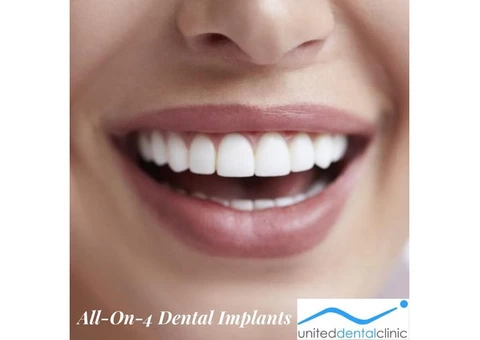 Recovery time for All-On-4 Dental Implants By United Dental Clinic