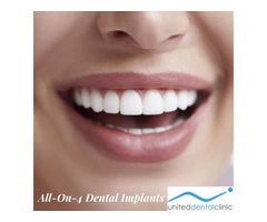 Recovery time for All-On-4 Dental Implants By United Dental Clinic