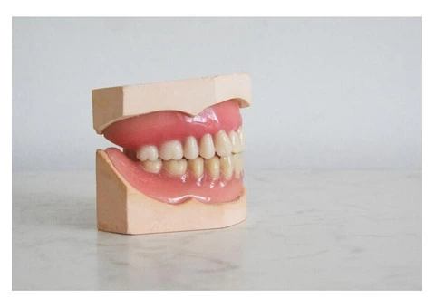 Impression Kit For Teeth