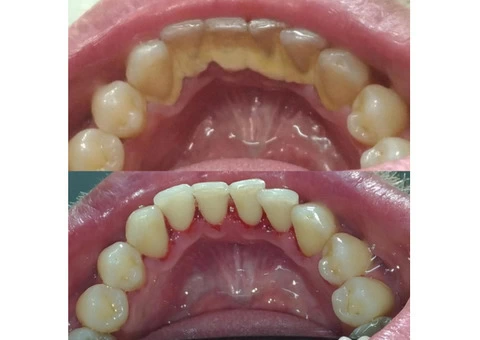 Seville Dental Clinic - Best Dental Checkups and Cleaning Services - 1/8