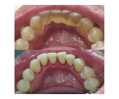 Seville Dental Clinic - Best Dental Checkups and Cleaning Services