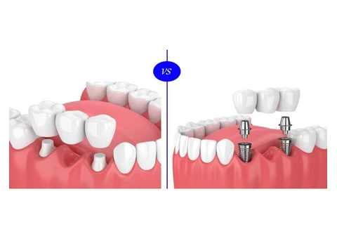Seville Dental Clinic - Best Dental Checkups and Cleaning Services - 2/8