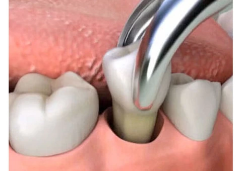 Seville Dental Clinic - Best Dental Checkups and Cleaning Services - 3/8