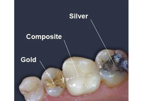 Seville Dental Clinic - Best Dental Checkups and Cleaning Services - 4/8