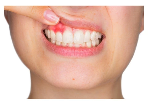 Seville Dental Clinic - Best Dental Checkups and Cleaning Services - 7/8