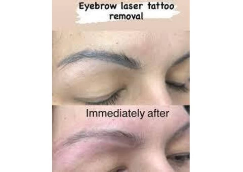 Get Best Microblading In Sydney