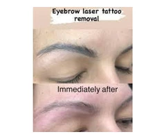 Get Best Microblading In Sydney