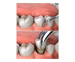 Dental Clinic Near Me