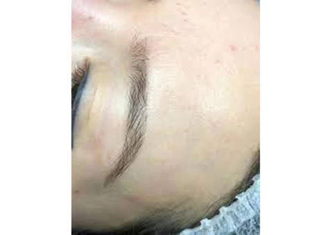 Get Skin Rejuvenation In Sydney