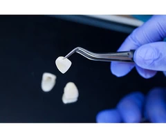 Improve Your Appearance With Porcelain Veneers Treatment In Melbourne