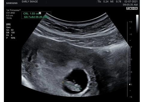 Stress Relief Scan When You Need it the Most