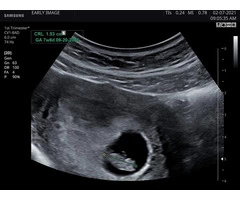 Stress Relief Scan When You Need it the Most