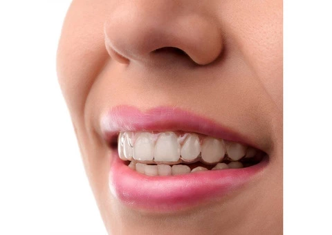 Invisalign Adelaide