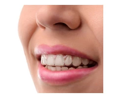 Invisalign Adelaide