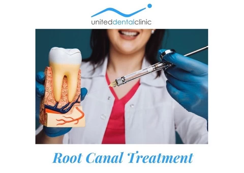 When Do You Need Root Canal Treatment?	 - United Dental Clinic