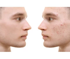 Medical Treatment Coogee | Skin Care Clinic Coogee