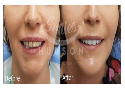 SmilesOnHudson - Newcastle