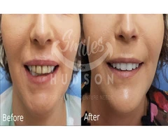 SmilesOnHudson - Newcastle