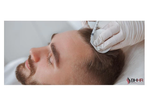 PRP Injection Hair