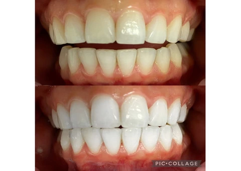 Dentist in Nundah, Brisbane - Toombul Smiles Dental Clinic - 3/8