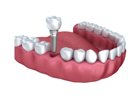 Dentist in Nundah, Brisbane - Toombul Smiles Dental Clinic - 5/8
