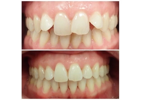 Dentist in Nundah, Brisbane - Toombul Smiles Dental Clinic - 6/8