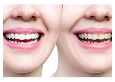 Local, Family Dentist in Bentleigh East | Ornate Dental Clinic - 1/3