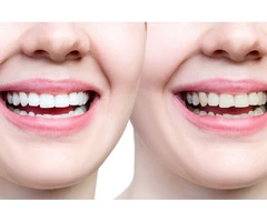 Local, Family Dentist in Bentleigh East | Ornate Dental Clinic