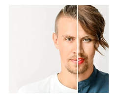 Transgender Hair Restoration