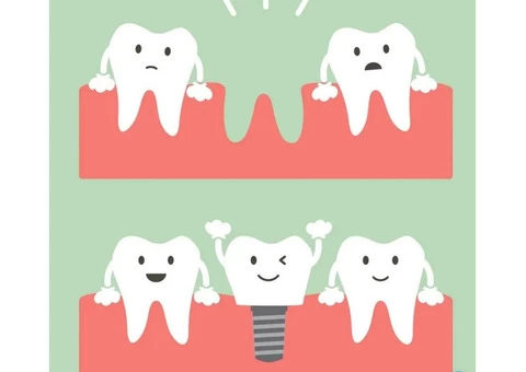 Tooth Implants Cost in Australia - My Gentle Dentist