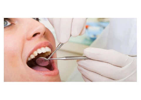 Find Affordable Porcelain Veneers for a Better Smile - 4/4