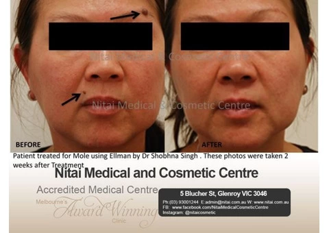 Buy Dermaceutic Laboratoire Products Online | Dermaceutic Stockists Australia - 3/8