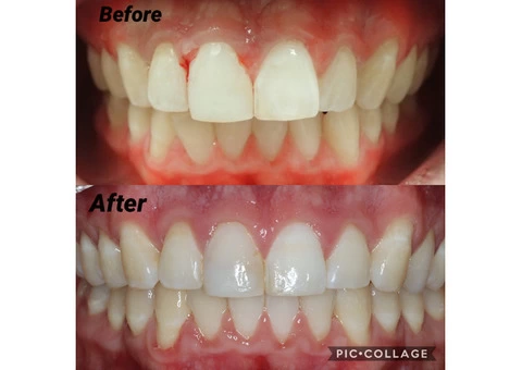 Emergency Dentist in Toombul, Brisbane - 2/7