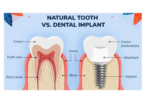 Emergency Dentist in Toombul, Brisbane - 7/7