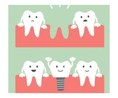 Dental Implants Brisbane