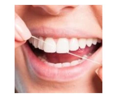 Understanding the Basics of Porcelain Veneer Services