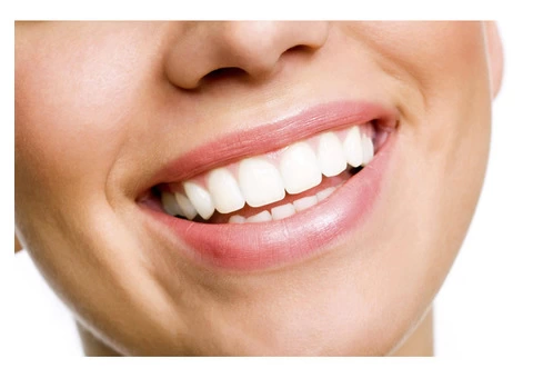 Best Dental Implants Treatment in Brisbane - Toombul Smiles Dental Clinic - 2/4