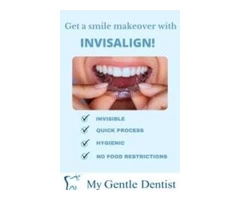 Invisalign Before and After – Invisalign Treatment