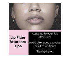 Lip Fillers Service in Joondalup Area Perth