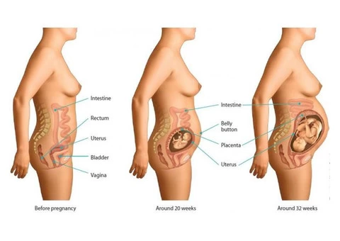 abdominoplasty Sydney - 2/2