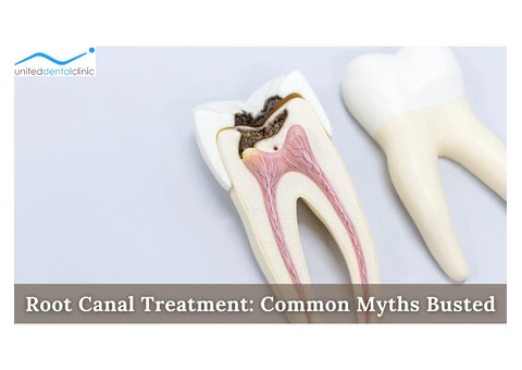 Root Canal Treatment: Common Myths Busted