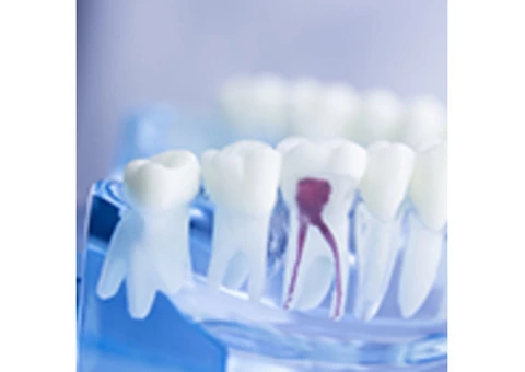 Affordable High-Quality Root Canal Treatment Melbourne CBD by Experienced Dentists - 2/3